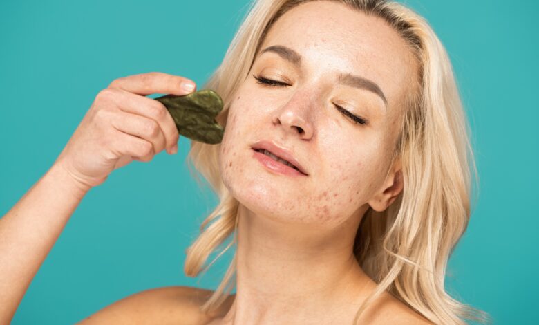 Concept d'imperfections au visage