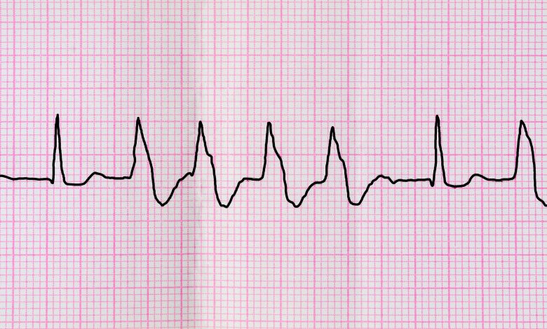 8 indicateurs santé pour avoir un cœur en pleine forme !