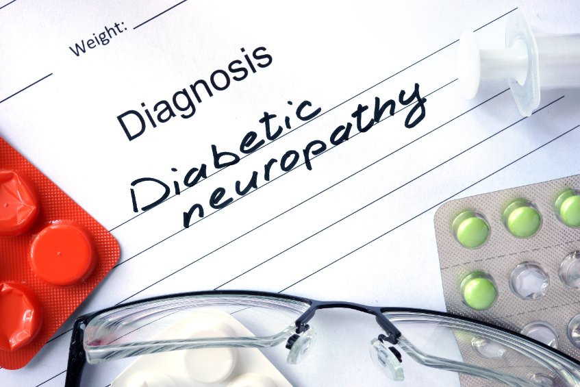 La neuropathie diabétique : étiologie, symptômes, prise en charge