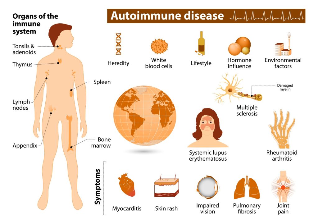 Les maladies auto-immunes : causes, symptômes et traitements