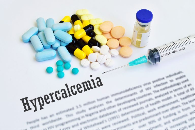 Hypercalcémie: causes, symptômes et traitements