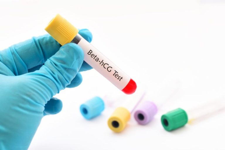 Beta HCG gonadotrophine chorionique humaine : valeurs normales, intérêt clinique