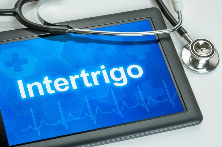 Intertrigos : classification, sémiologie, traitement