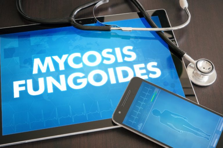 Mycosis fongoïde : causes, symptômes et traitements