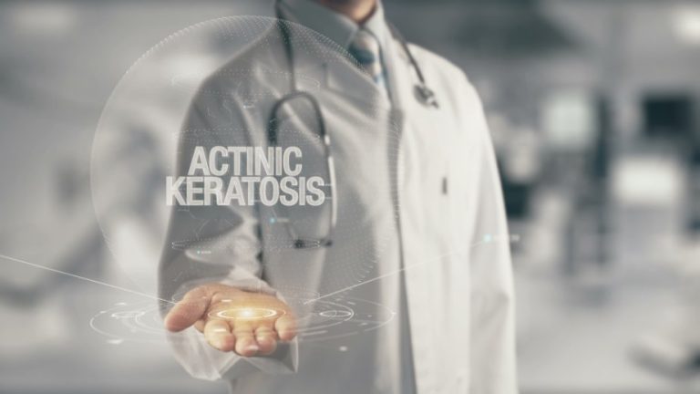 Kératose actinique : étiologie, sémiologie, diagnostic, traitement