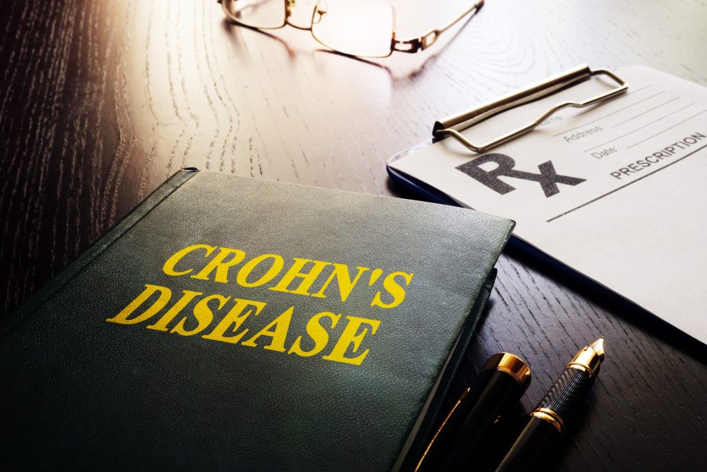 Maladie de CROHN et Anticorps anti Saccharomyces cerevisiae : que savoir ? 85006947 M 1024x683