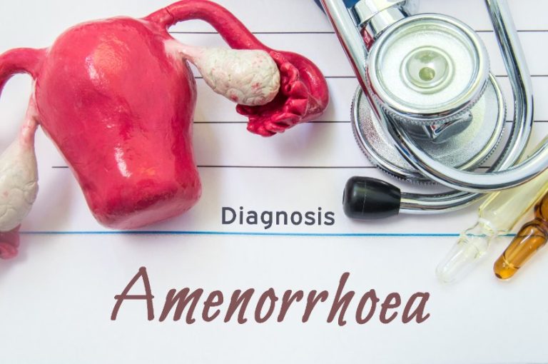 Aménorrhées et spanioménorrhées fonctionnelles : causes, diagnostic et traitement
