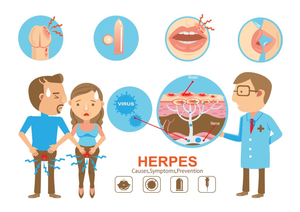 Herpès génital : mode de transmission et symptômes