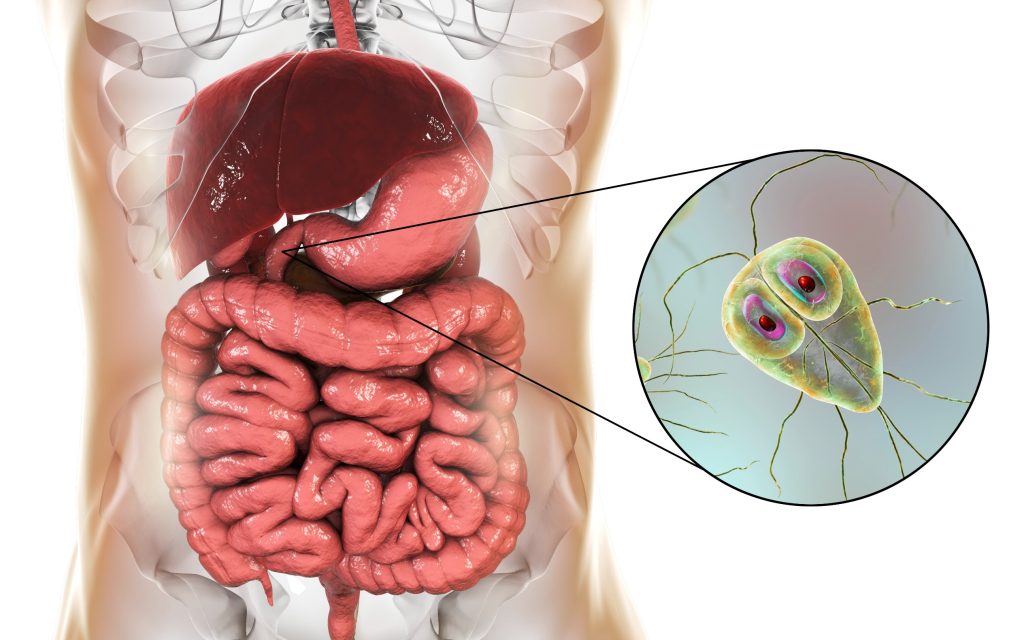 GIARDIASE : causes, symptômes et traitements