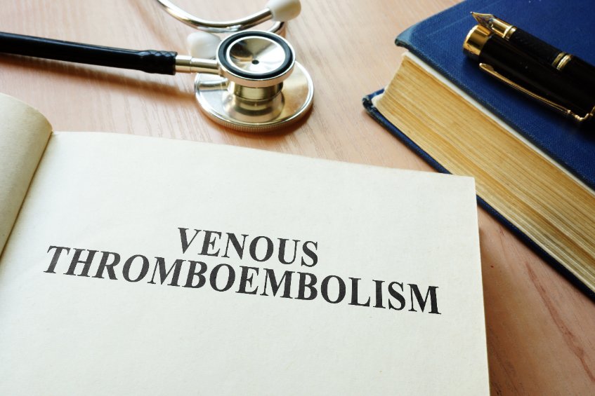 Maladie thromboembolique veineuse (MTEV) : quelle prévention en médecine ?