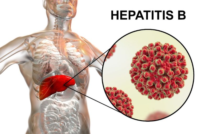 L’hépatite B : Causes, symptômes, diagnostic, traitements et prévention
