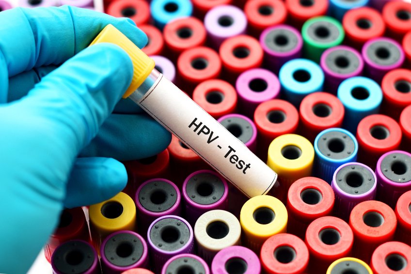 Recherche des papillomavirus humains (HPV) : quel intérêt dans le dépistage des lésions précancéreuses et cancéreuses du col de l’utérus ?