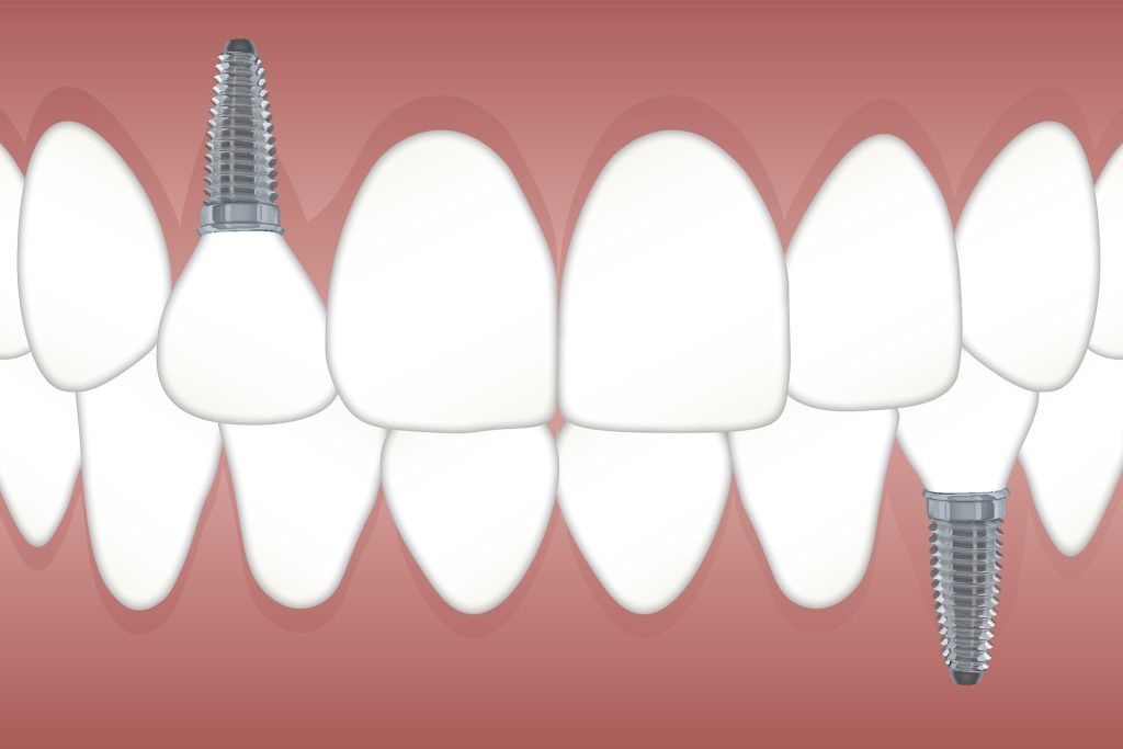 Teeth 3597679 1920 1024x683