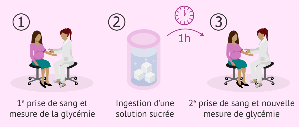 Le test O’Sullivan ou le test de tolérance au glucose : comment le réaliser ? Test De O Sullivan 1024x435