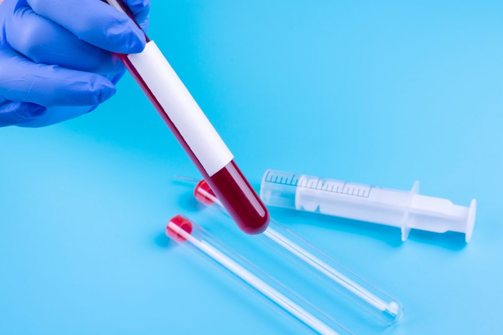 Analyse bêta-hCG : comment interpréter les résultats ? Test sanguin bêta-hCG