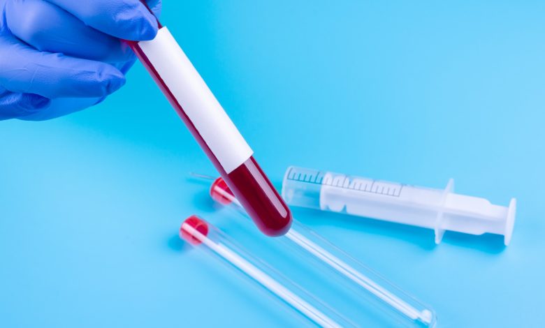 Test sanguin bêta-hCG