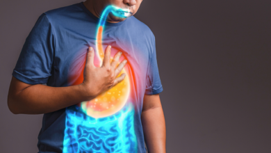 Maladie de Crohn