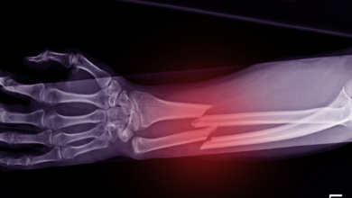 Fracture de fatigue