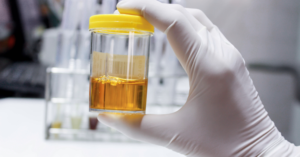 urine jaune fluo