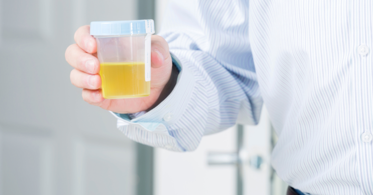 Urine jaune fluo : quelles sont les causes et faut-il s’inquiéter ? urine jaune fluo