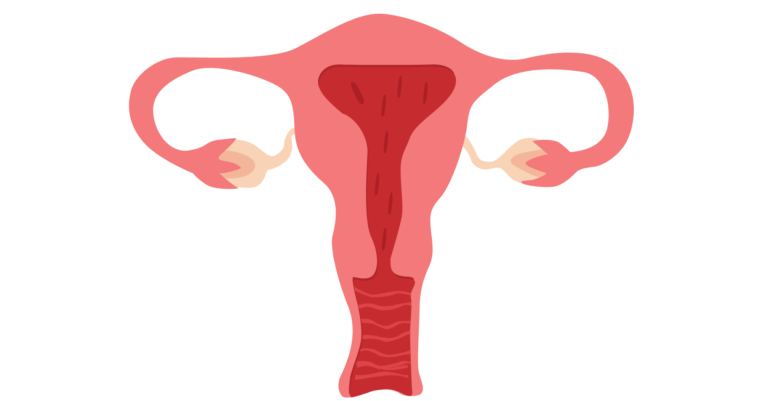 Vaginisme : comprendre les causes, les symptômes et les solutions pour le surmonter Vaginisme
