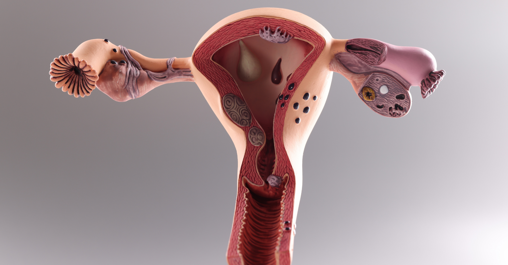 col uterus debut grossesse image