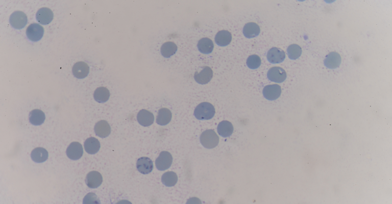 Réticulocytes : que signifie leur taux dans une prise de sang ? Réticulocytes